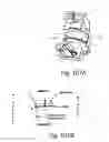 Fig. 75 - Method for creating a customized arthroplasty resection guide utilizing two-dimensional imaging