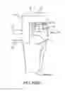 Fig. 82 - Method for creating a customized arthroplasty resection guide utilizing two-dimensional imaging