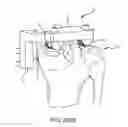Fig. 85 - Method for creating a customized arthroplasty resection guide utilizing two-dimensional imaging
