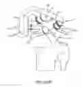 Fig. 86 - Method for creating a customized arthroplasty resection guide utilizing two-dimensional imaging