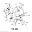 Fig. 89 - Method for creating a customized arthroplasty resection guide utilizing two-dimensional imaging