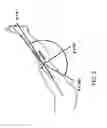 Fig. 05 - Implant planning using captured joint motion information