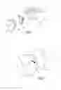 Fig. 02 - Determining implantation configuration for a prosthetic component or application of a resurfacing tool