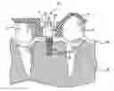 Fig. 01 - Apparatuses and methods for implanting dental implants