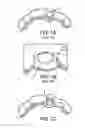 Fig. 02 - Apparatuses and methods for implanting dental implants