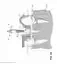 Fig. 07 - Apparatuses and methods for implanting dental implants