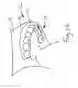 Fig. 28 - Bone foundation guide system and method
