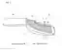 Fig. 03 - IMPRESSION TRAY