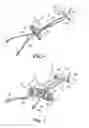 Fig. 06 - Surgical implant system and method