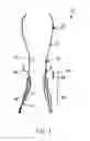 Fig. 02 - Transcatheter stent-valves