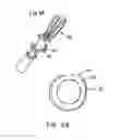 Fig. 04 - Transcatheter stent-valves