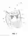 Fig. 02 - HEART VALVE PROSTHESIS WITH COLLAPSIBLE VALVE AND METHOD OF DELIVERY THEREOF