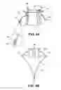 Fig. 05 - HEART VALVE PROSTHESIS WITH COLLAPSIBLE VALVE AND METHOD OF DELIVERY THEREOF
