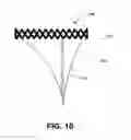 Fig. 09 - HEART VALVE PROSTHESIS WITH COLLAPSIBLE VALVE AND METHOD OF DELIVERY THEREOF