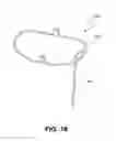 Fig. 16 - HEART VALVE PROSTHESIS WITH COLLAPSIBLE VALVE AND METHOD OF DELIVERY THEREOF