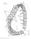 Fig. 03 - Methods, devices, and systems for percutaneously anchoring annuloplasty rings