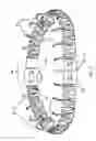 Fig. 06 - Methods, devices, and systems for percutaneously anchoring annuloplasty rings