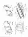 Fig. 10 - Methods, devices, and systems for percutaneously anchoring annuloplasty rings