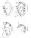 Fig. 15 - Methods, devices, and systems for percutaneously anchoring annuloplasty rings