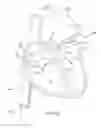 Fig. 19 - Methods, devices, and systems for percutaneously anchoring annuloplasty rings