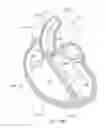 Fig. 20 - Methods, devices, and systems for percutaneously anchoring annuloplasty rings