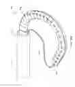 Fig. 23 - Methods, devices, and systems for percutaneously anchoring annuloplasty rings