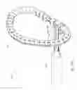 Fig. 25 - Methods, devices, and systems for percutaneously anchoring annuloplasty rings