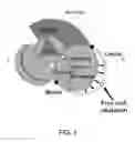 Fig. 02 - Devices and methods for treating functional tricuspid valve regurgitation