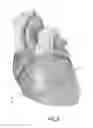 Fig. 07 - Devices and methods for treating functional tricuspid valve regurgitation