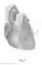 Fig. 08 - Devices and methods for treating functional tricuspid valve regurgitation