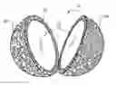 Fig. 01 - Implant with porous outer layer