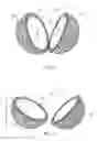 Fig. 02 - Implant with porous outer layer