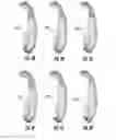 Fig. 11 - Posterior-Stabilized Knee Implant Components and Instruments