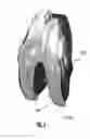 Fig. 16 - Posterior-Stabilized Knee Implant Components and Instruments