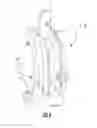 Fig. 17 - Posterior-Stabilized Knee Implant Components and Instruments