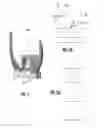 Fig. 19 - Posterior-Stabilized Knee Implant Components and Instruments