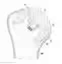 Fig. 01 - Stemless humeral component of an orthopaedic shoulder prosthesis