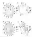 Fig. 07 - Stemless humeral component of an orthopaedic shoulder prosthesis