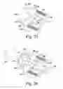 Fig. 12 - Stemless humeral component of an orthopaedic shoulder prosthesis