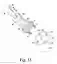 Fig. 16 - Stemless humeral component of an orthopaedic shoulder prosthesis
