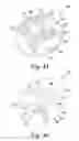 Fig. 23 - Stemless humeral component of an orthopaedic shoulder prosthesis
