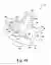Fig. 26 - Stemless humeral component of an orthopaedic shoulder prosthesis