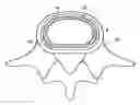 Fig. 01 - In-situ formed intervertebral fusion device and method