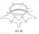 Fig. 07 - In-situ formed intervertebral fusion device and method