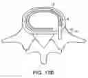 Fig. 22 - In-situ formed intervertebral fusion device and method