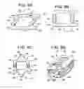 Fig. 08 - Lateral spondylolisthesis reduction cage