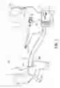 Fig. 02 - Surgical alignment using references