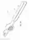 Fig. 24 - Methods of repairing a joint using a wedge-shaped implant