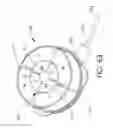 Fig. 65 - Adjustable implant and method of use