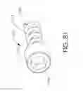 Fig. 85 - Adjustable implant and method of use